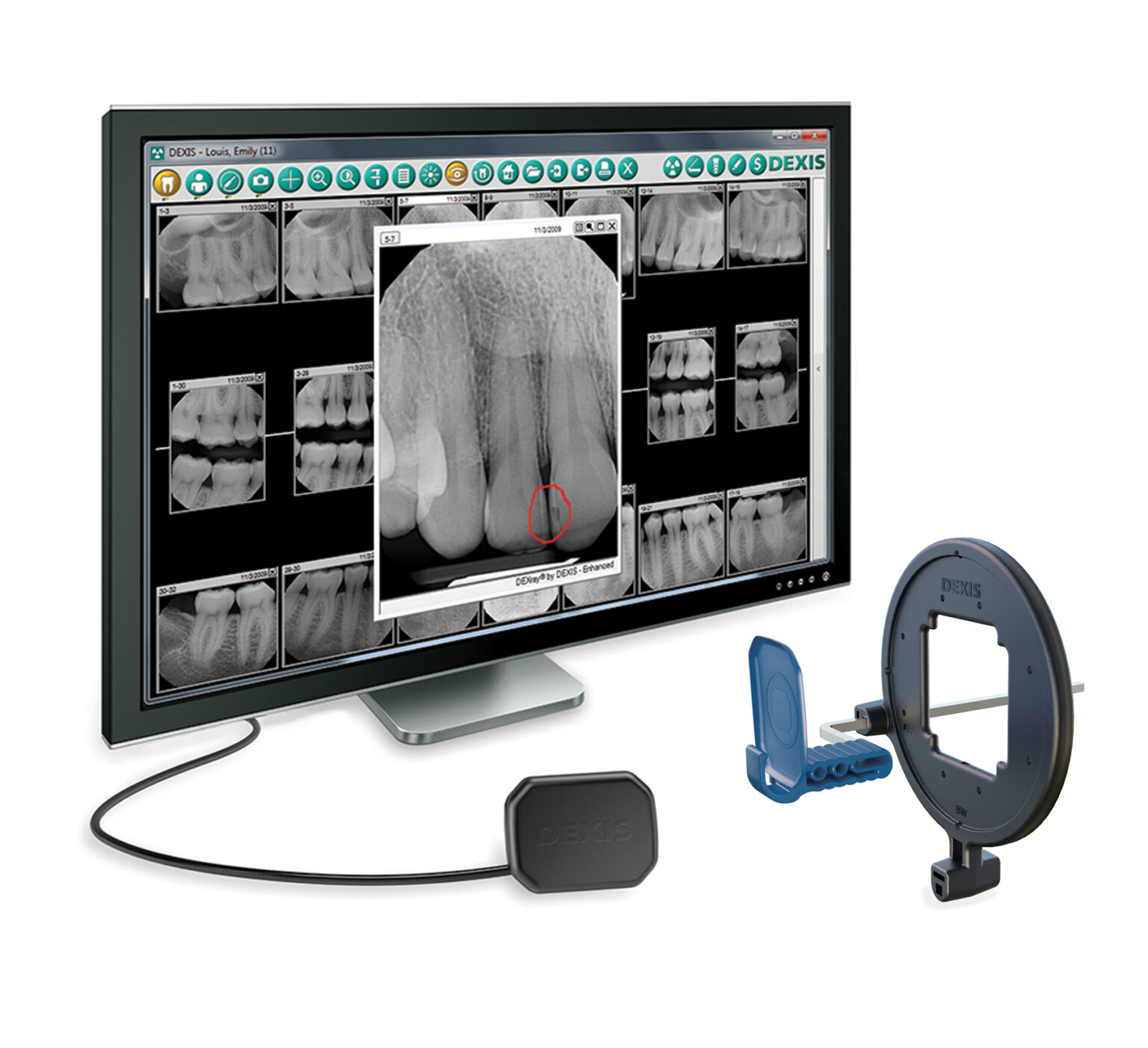 Advanced Technology Tyler Endodontics